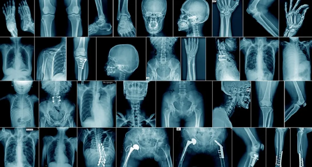 A importância da radiologia no diagnóstico médico