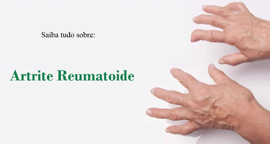 Artrite Reumatoide