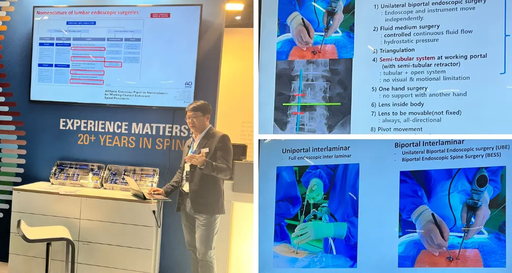 Cirurgia Endoscópica por Robô: Conheça as técnicas utilizadas no tratamento da coluna vertebral