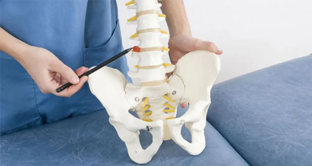 Como é a cirurgia de hérnia de disco?