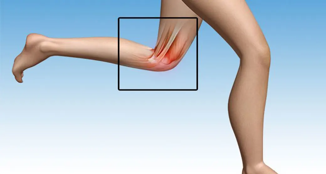 Como prevenir e tratar a lesão da pata de ganso?