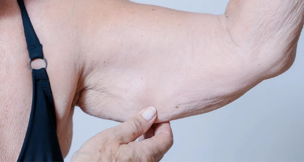 Como saber se você tem sarcopenia?