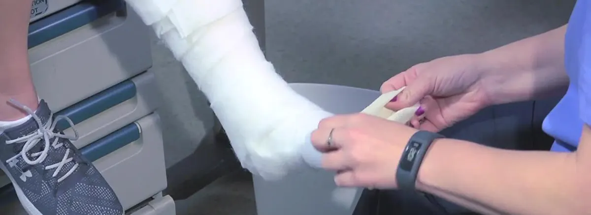 diferença entre gesso bota ortopédica