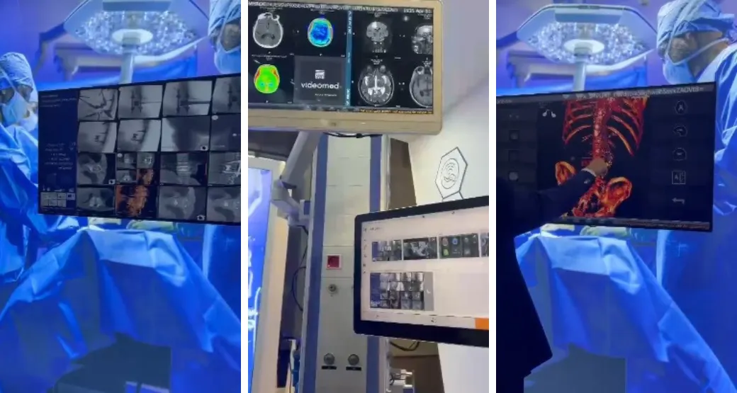 Exames de imagem com tecnologia em 3D: Tomografia dentro do centro cirúrgico em conexão