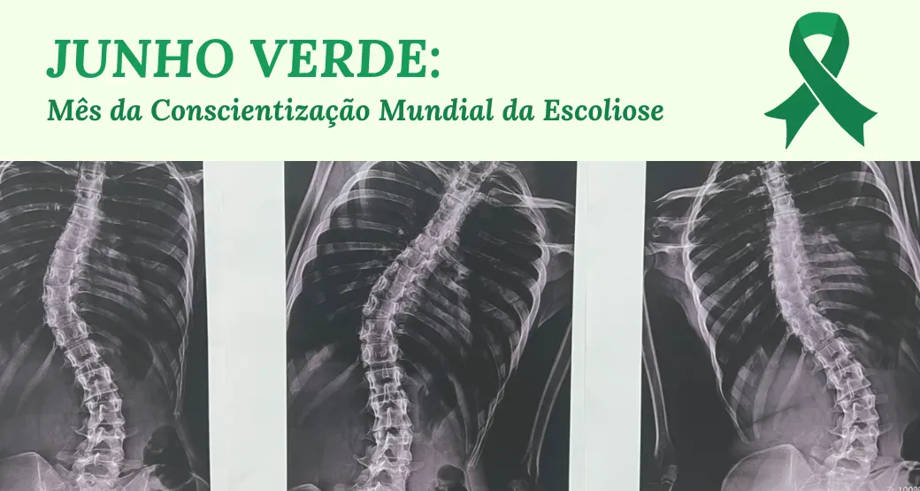 JUNHO é o mês de conscientização mundial da Escoliose