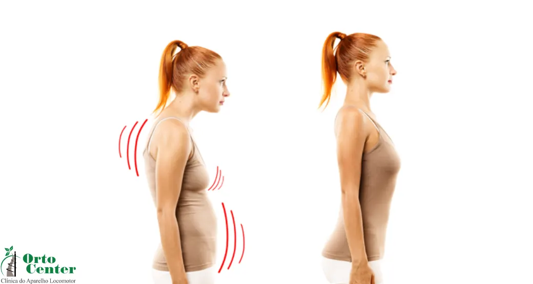 O que é Reeducação Postural Global
