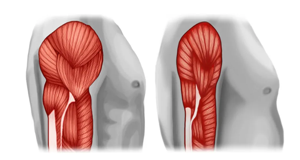 O que é Sarcopenia, afinal?