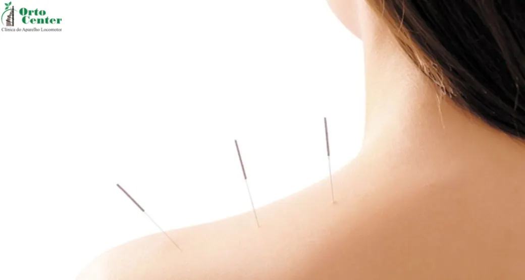 Por que fazer acupuntura?