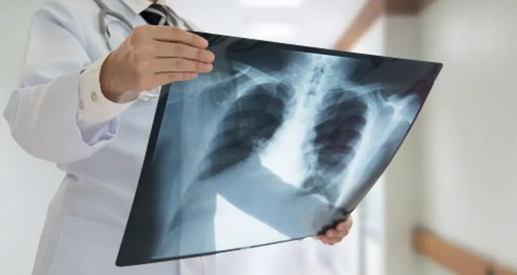 Quando é indicado fazer uma radiografia?