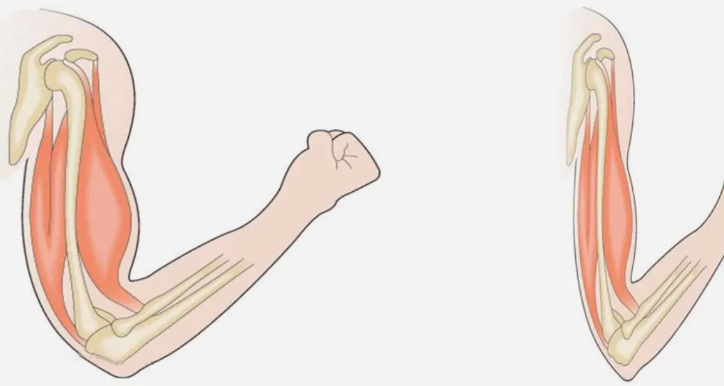 SARCOPENIA: A doença é grave... Previna-se!