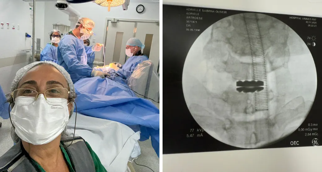 Artroplastia discal cervical: Uma abordagem cirúrgica para a doença discal