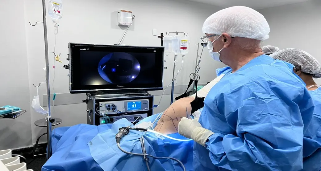 Artroscopia resolve a Síndrome Acromial ou Síndrome do Impacto?