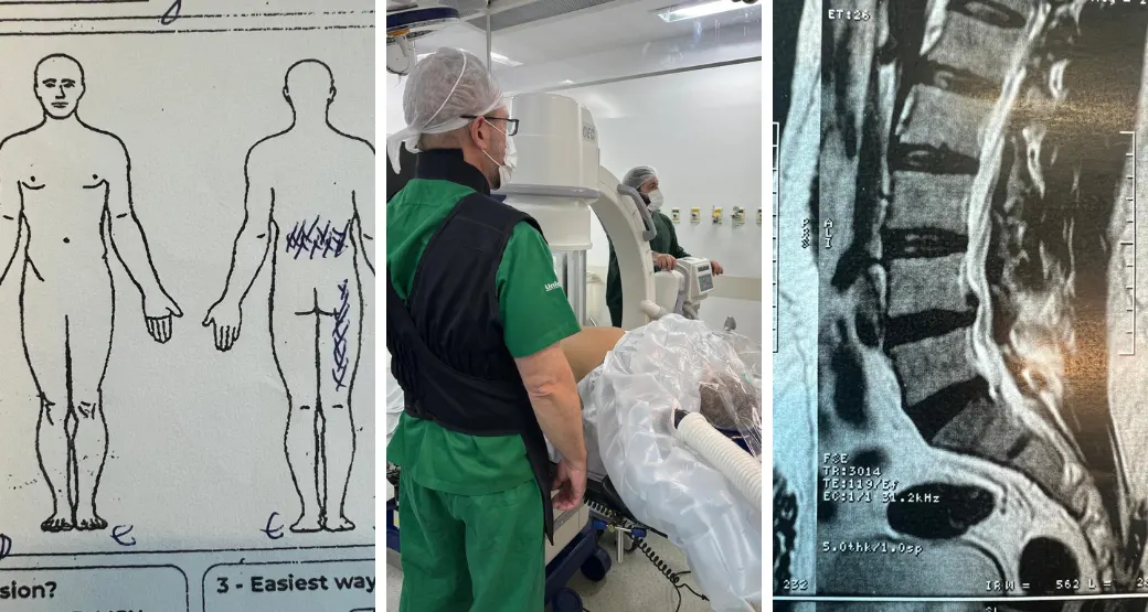 Cirurgia de hérnia de disco lombar: um caso clínico interessante e desafiador