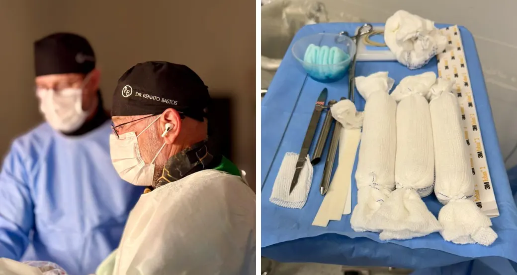 Cirurgia endoscópica de coluna: Alternativa viável e segura frente às técnicas convencionais