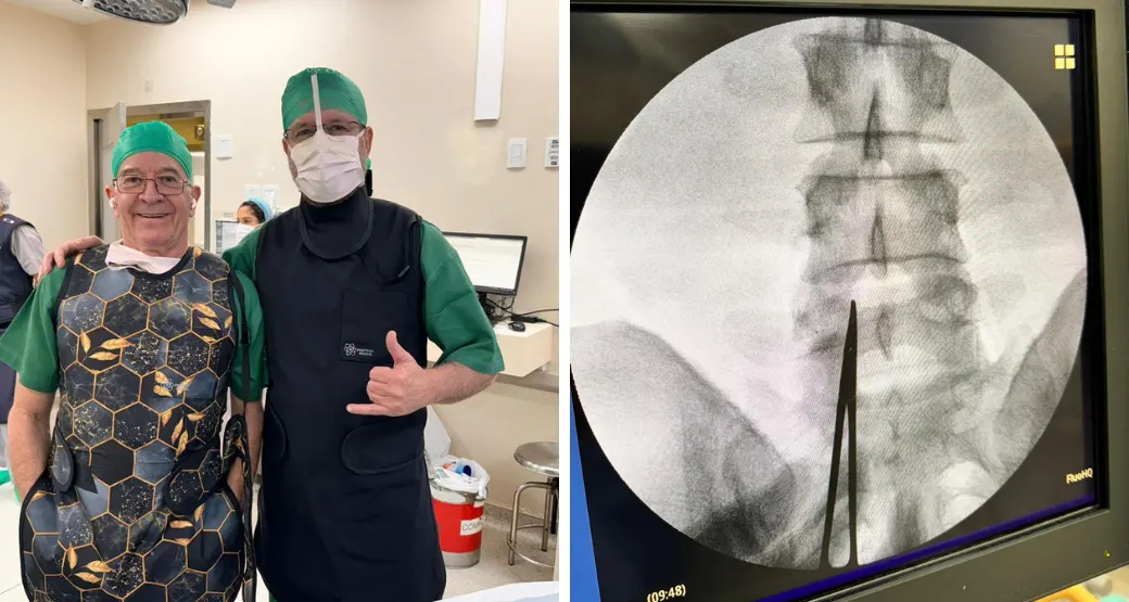 Conheça duas curiosidades na Endoscopia da coluna lombar