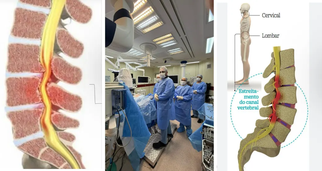 Dor, dormência ou fraqueza nas pernas que piora com a caminhada? Procure tratamento.