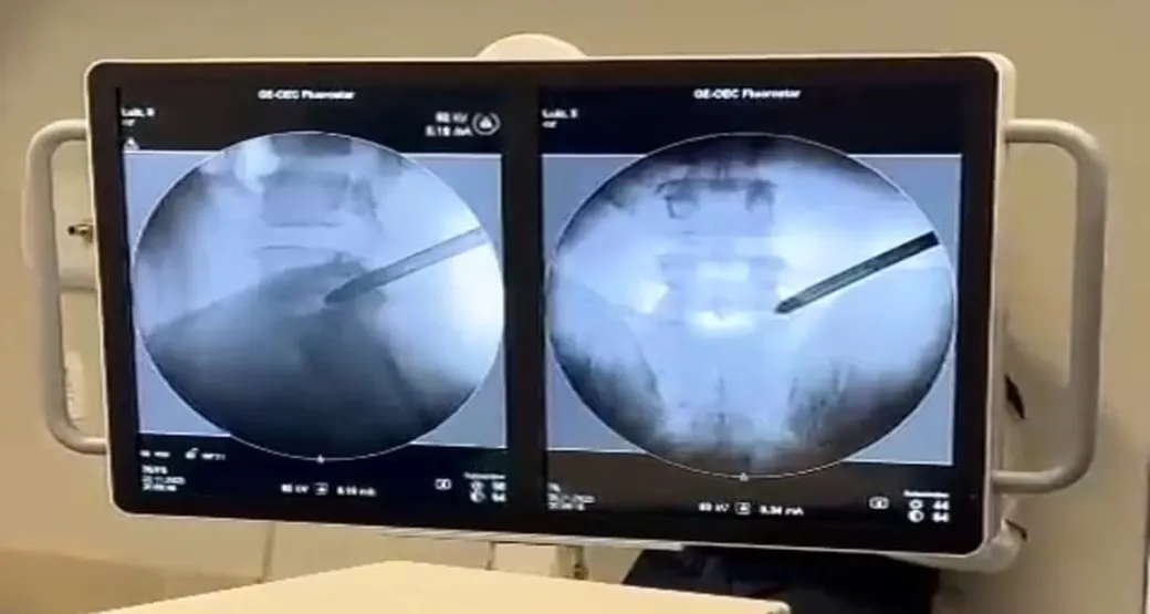 Endoscopia da coluna lombar: seguir o laudo de imagens ou o histórico e exame físico do paciente?