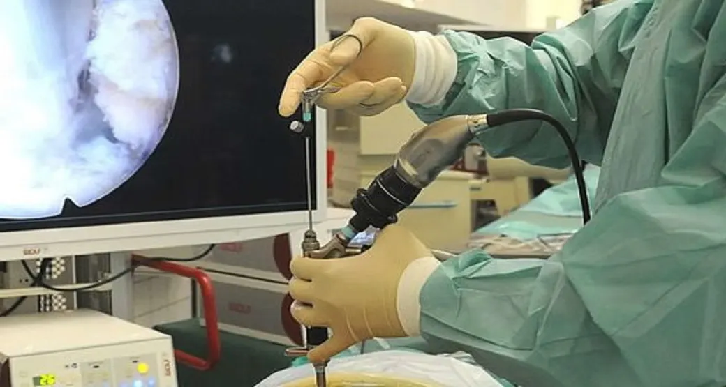 Endoscopia lombar em paciente com hérnia e artropatia