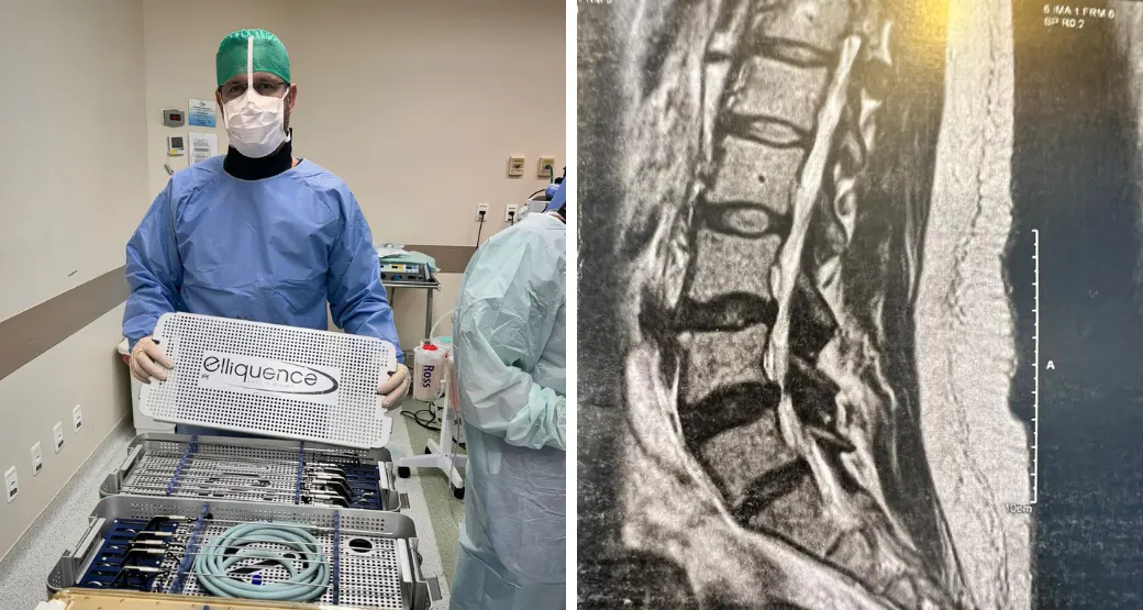 ENTREVISTA: Conheça o passo a passo de uma Endoscopia de coluna em paciente com má formação congênita