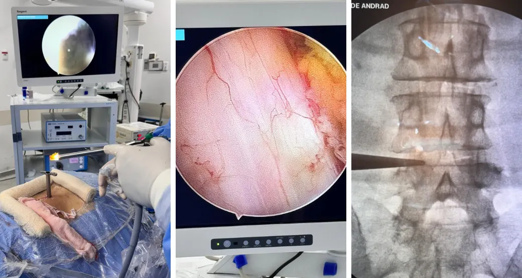Paciente diagnosticado com lombociatalgia? O que fazer?