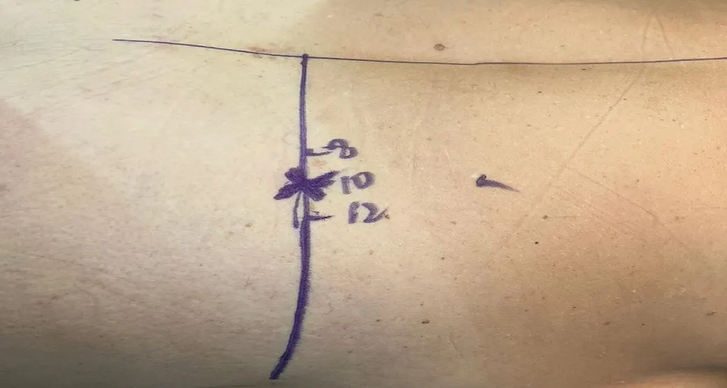 Procedimentos endoscópicos variam de acordo com a complexidade dos sintomas